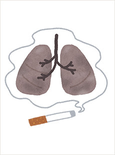 肺がん（はいがん）